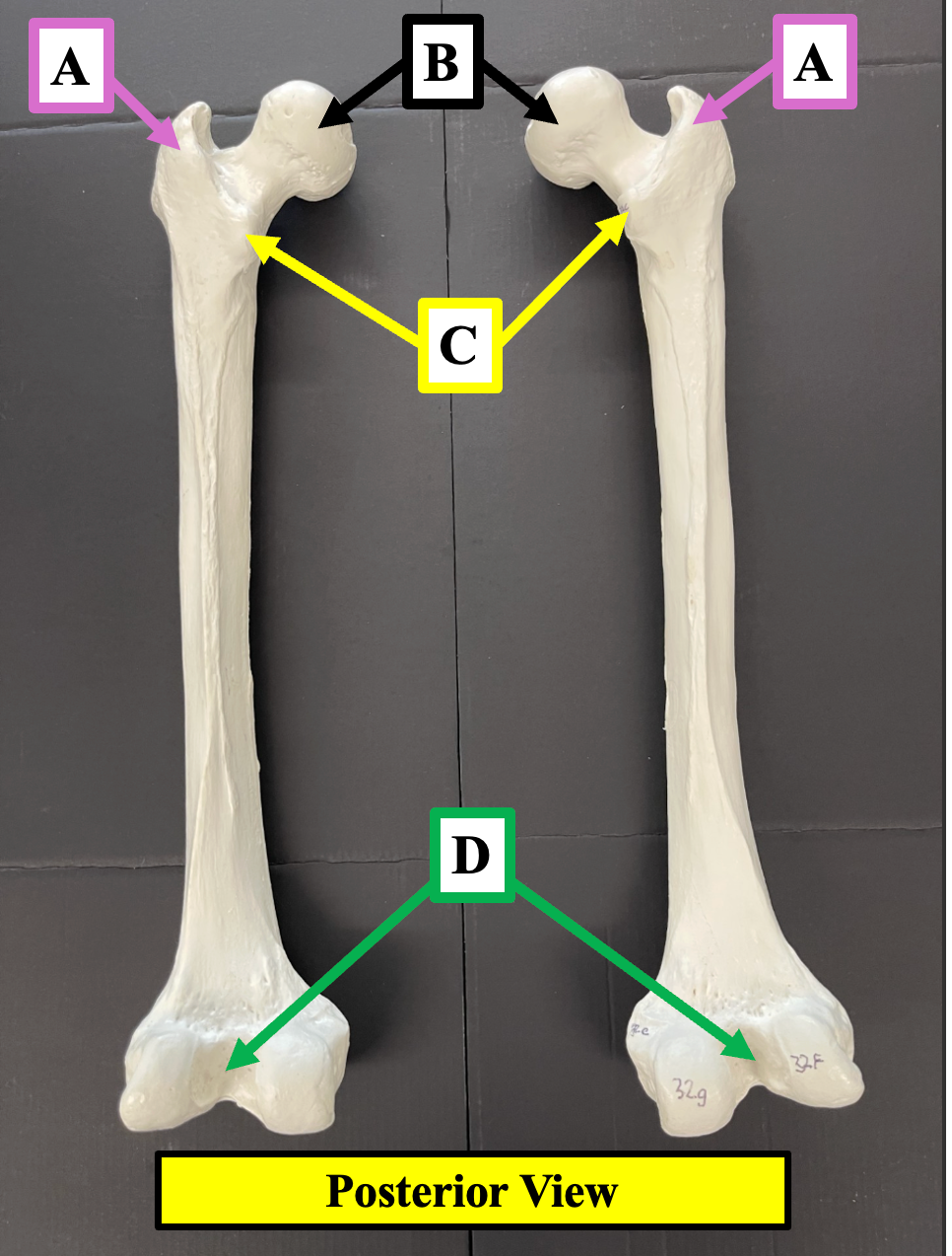 <p>Identify the name of the bony landmark of the femur that label <strong>C </strong>is pointing to.</p>