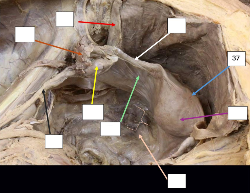 <p>Identify</p><p>Side Question:</p><p>Blood Supply?</p><p>Venous Drainage?</p><p>Nerve Supply?</p><p>Lymph Drainage?</p>