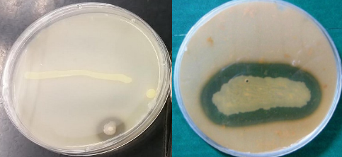 <p>clear zone around growth</p>