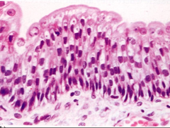 <p>Stratified, but cell shape is diff depending on layer; found in organs that change shape</p>