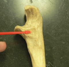 <p>a small, smooth depression on the outer (lateral) side of the upper ulna near the elbow. Its function is to hold the round head of the radial bone to make a joint and let the radius spin over the ulna so your palm can face up and down.</p>