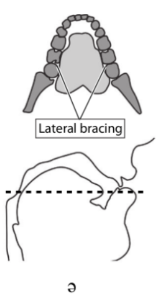 <p>curcial for sounds requiring airflow to be directed along tongue’s midline</p><ul><li><p>involves side of tongue contacting inner sides of teeth or upper lateral regions of mouth</p></li><li><p>provides mechanism for achieving different shapes of tube-like cavity by stabilizing tongue in back</p></li></ul><p></p>