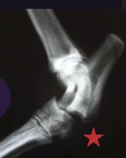 <p>What view is this? When stress is applied, what joint is opened up? Is this unstable or stable?</p>