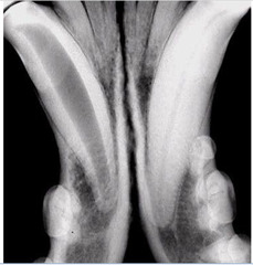 <p>Which tooth is normal, which is diseased? How do you know?</p>