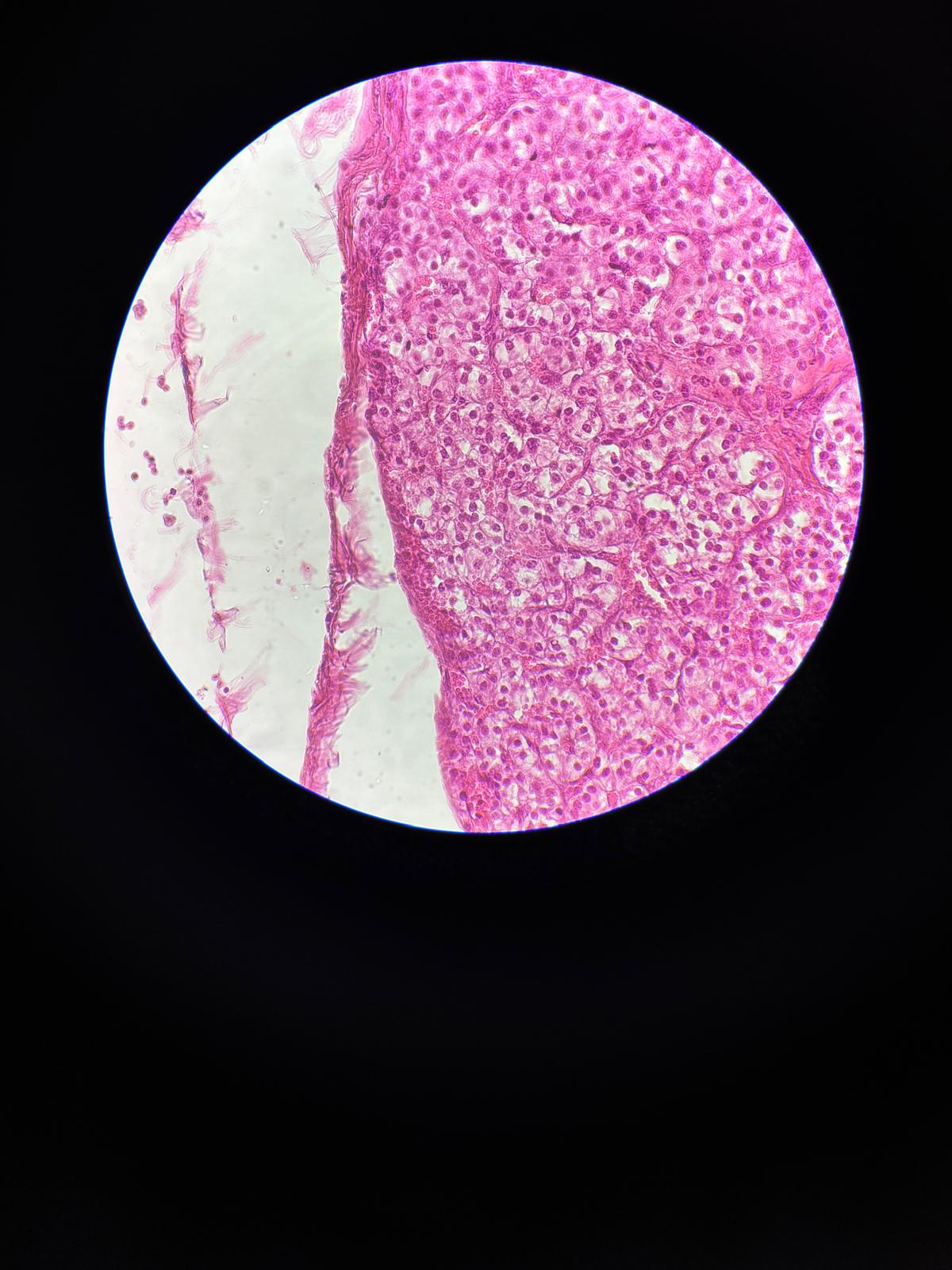 <p>Consists of Principal cells (Chifs Cells).</p>