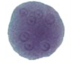 <p>What Amebae is this? Is this the trophozoite or cyst form?</p>