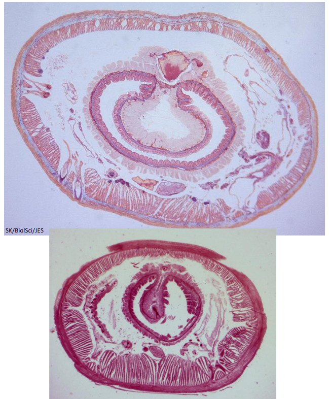 <p>Earthworm cross section </p>
