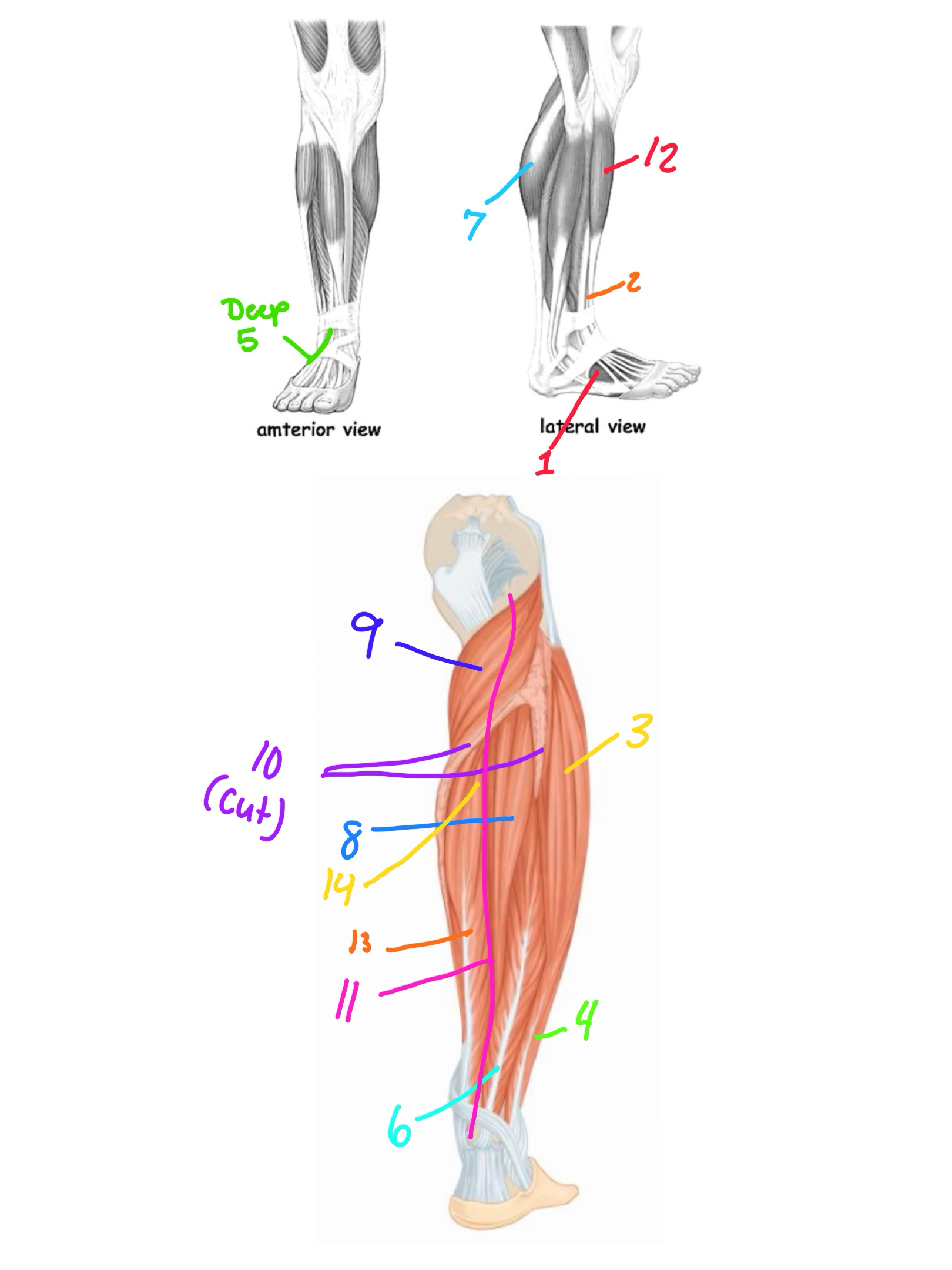 <p>Flexor Hallucis Longus</p>