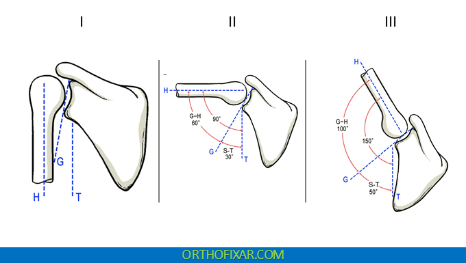 <p>A concept that claims that the GH joint and the ST joint operate on a 2:1 ratio (or rhythm); for every 2 degrees of GH abduction (or flexion), the scapula must upwardly rotate 1 degree</p><ul><li><p>In order to see this on a person, we can pay attention to the inferior angle of their scapula as they perform shoulder abduction</p></li><li><p>ex. If you were using a goniometer, the axis would be placed on the superior angle of the scapula, with the stationary arm pointed downwards. The moving arm would follow the inferior angle of the scapula as one abducts.</p></li></ul><p></p>