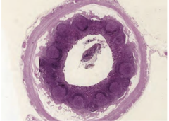 <p>what is the histological classification of this organ's epithelium</p>