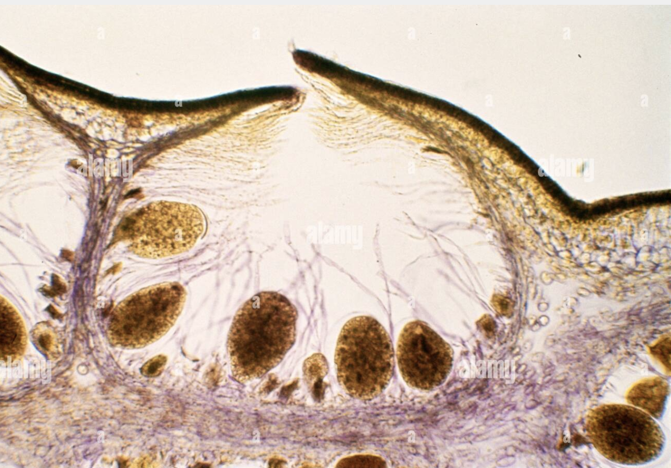 <p>Based on the image, identify whether the Fucus oogonia are mature or immature.</p>