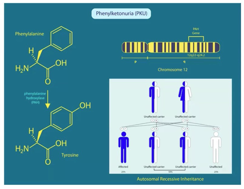<p>Deficiency of <strong>phenylalanine hydroxylase</strong>; causing higher levels of phenylalanine that can damage nerve function, cause delayed mental and social skill development, lower head size, hyperactivity, jerking movements of arms and legs, seizures, pale skin, tremors.</p>