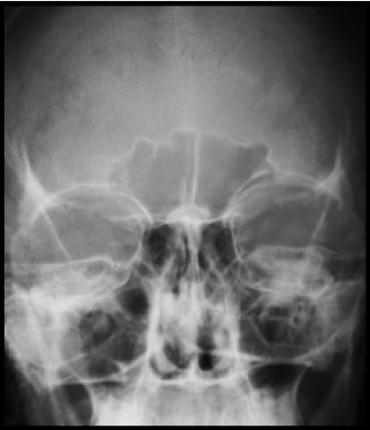 <p>What view is this?</p>