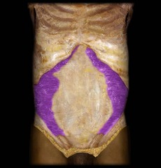 <p>identify the structure</p>