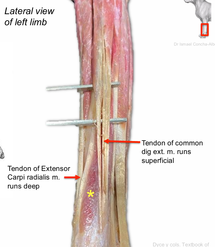 <p>Abductor digit I longus m.</p>