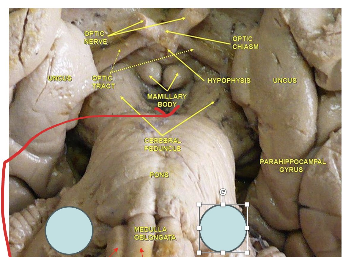 <p>The gray circles are which structures in the metencephalon?</p>
