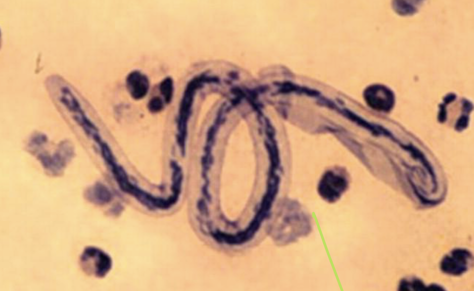 <p>What parasite is this?</p>