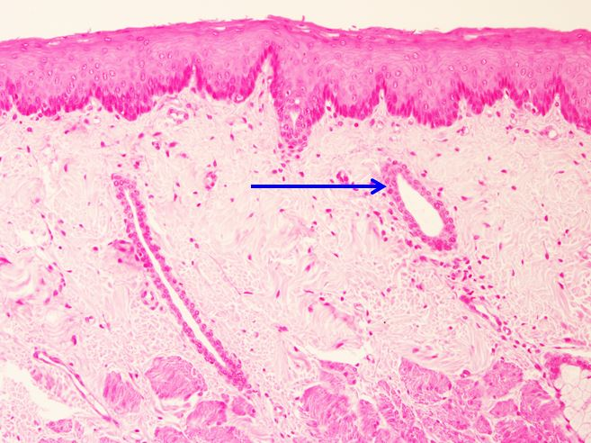<p>Biểu mô gì ?</p>