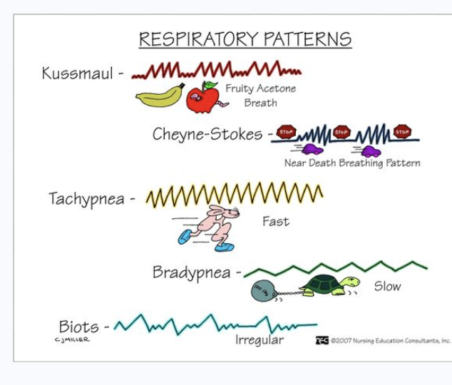 <p>Respiratory  patterns  </p>