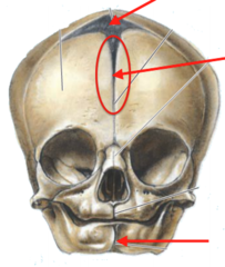 <p>Which structure is circled on the developing skull?</p>