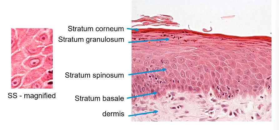 <p>Many desmosomes in the spinosum layer…</p>