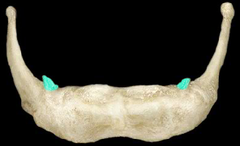 <p>sừng</p>