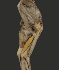 <p>What muscle is highlighted in the picture?</p>