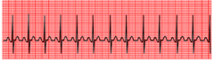 <p>fast, rapid</p>
