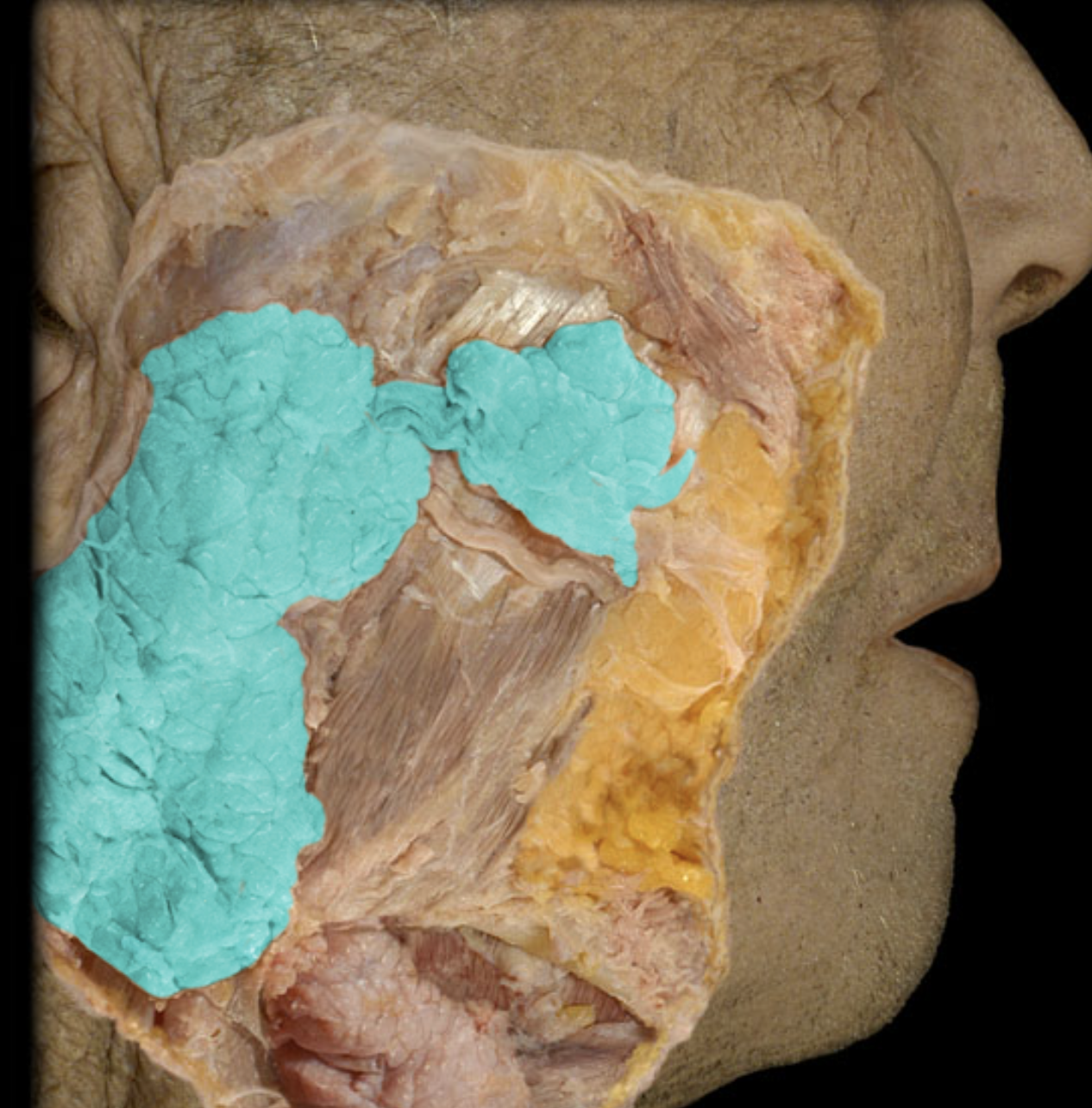 term image