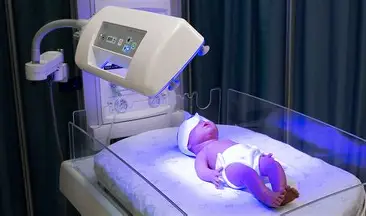 <ol><li><p><span style="color: rgb(182, 87, 229);"><strong>phototherapy</strong></span></p></li></ol><ul><li><p>strip down to diaper and expose skin</p></li><li><p><span><strong>cover eyes</strong></span></p></li></ul><p></p><ol start="2"><li><p><span style="color: rgb(240, 79, 79);"><strong>NO lotions</strong></span>!!</p></li></ol><ul><li><p>causes burns</p></li></ul><p></p><p></p><ol start="3"><li><p>the more they <span style="color: rgb(145, 121, 51);"><strong>poop, the better bilirubin</strong></span> levels will be</p></li></ol><p></p>