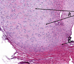 <p>What is indicated in the arrows labeled 'A' in this slide of canine claw?</p>
