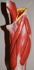 <p>Insertion</p>