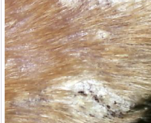 <p>What secondary lesion is this? </p>