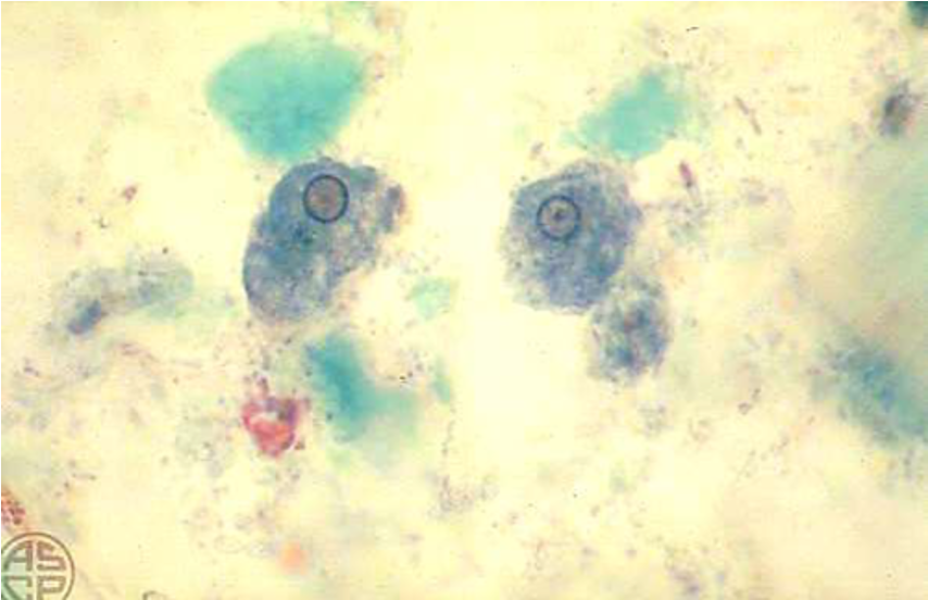 <p><span>16&nbsp;<strong>µm</strong></span></p>