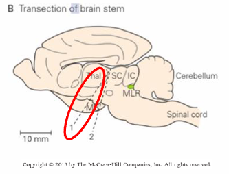 <p>brainstem transected from the rostral margin of the superior colliculi to a point immediately rostral to the mammillary bodies, brainstem centres remain connected to spinal cord, leads to spontaneous stepping.</p>