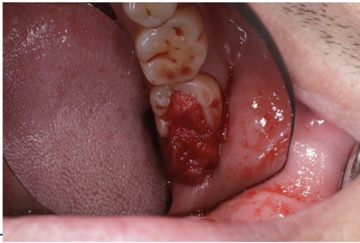 <p>CHẨN ĐOÁN?</p>