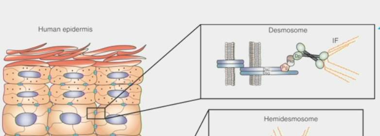 <ul><li><p>a trans-membrane structure by which two adjacent cells are attached</p></li><li><p>formed from protein plaques in the cell membranes linked by <strong>intermediate filament </strong>cytoskeleton</p><ul><li><p>forms trans-cellular network of “cables”</p></li></ul></li><li><p>disruption compromises <strong>epithelial</strong> tissue integrity</p></li></ul><p></p>