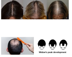 <p>What is this disease?</p>