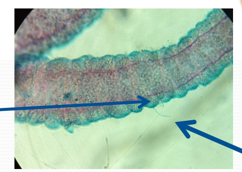 <p>hair-like trigger in the nematocyst .</p>