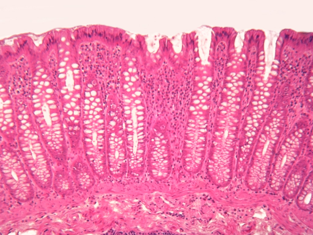 <p>this image is of what structure</p>