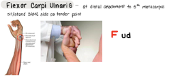 <p>F ud</p>