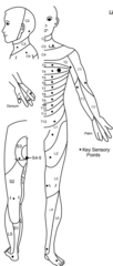 <p>Spinal cord injuries are classified as complete or incomplete, based on the presence of sensory and motor function below the level of injury.</p>