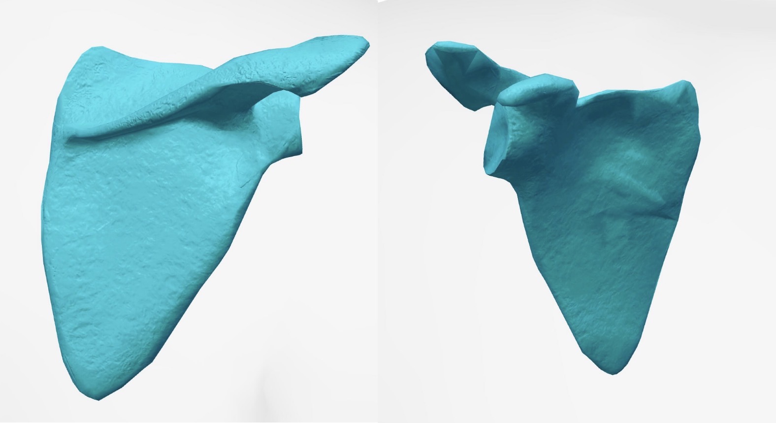 <p>Scapula: Muscle Attachments</p>