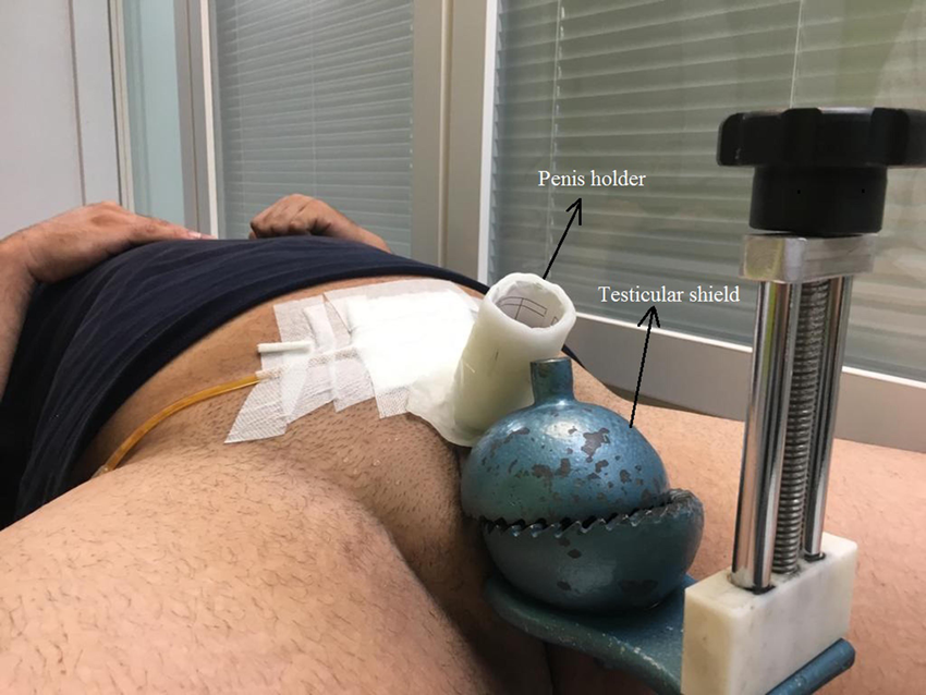 <p>C reduce the amount of internal scatter to the testes</p><div data-type="horizontalRule"><hr></div><p></p><p>The testicular shield reduces the amount of internal scatter to the testes. Cuz usually they surgically remove the cancerous testicle so shield the remaining one</p>