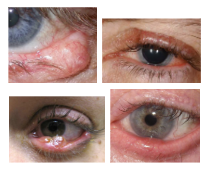 <p>What is the most likely diagnosis ?</p>