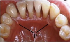 <p>Are bilateral abnormal variants likely to be inherited/systemic?</p>