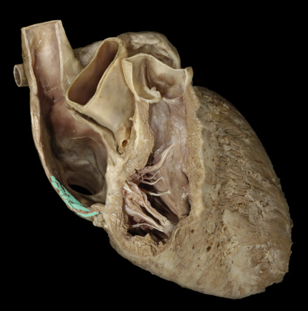 <p>Identify the feature of the right atrium</p>