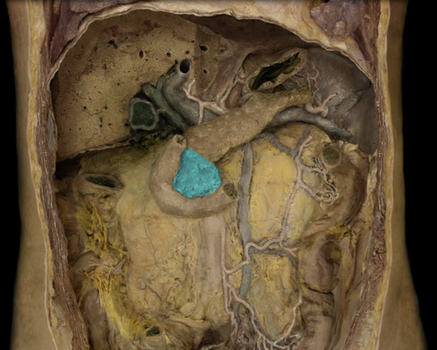 term image