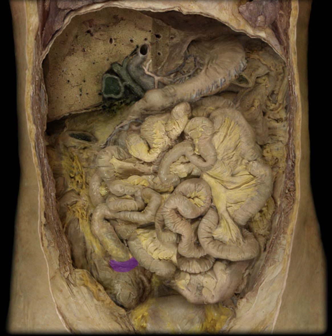 knowt flashcard image