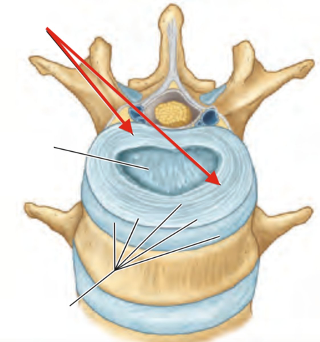 <p>Outer ring of intervertebral disc</p>